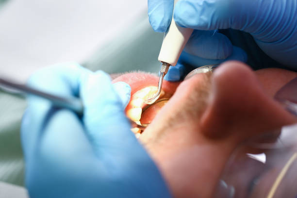 Best Emergency Gum Treatment in San Felipe, TX