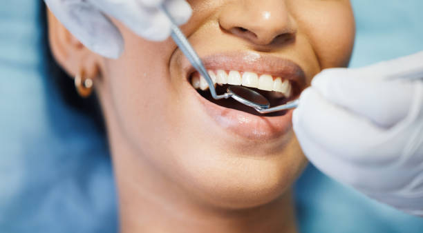 Best Emergency Tooth Extraction in San Felipe, TX