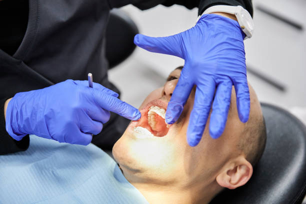 Best Emergency Dental Care for Broken or Chipped Teeth in San Felipe, TX